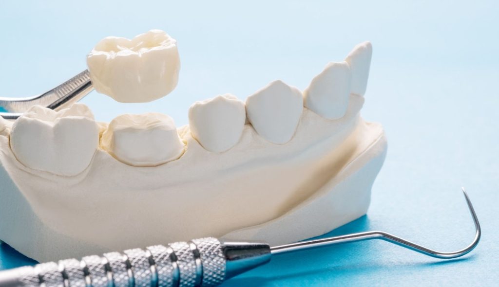 From Cavities To Crowns: Comprehensive Care With A Family & Cosmetic Dentist